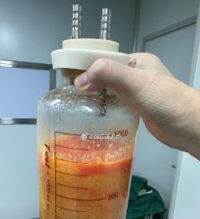 海东水动力吸脂手术要做多久？